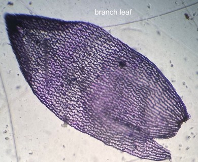 Sphagnum perichaetiale