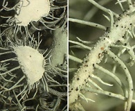 Usnea intermedia