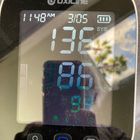 Oxiline Pressure 9 Pro Review: State Of The Art Blood Pressure Monitor