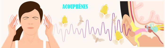 Comment soigner ses acouphènes ?