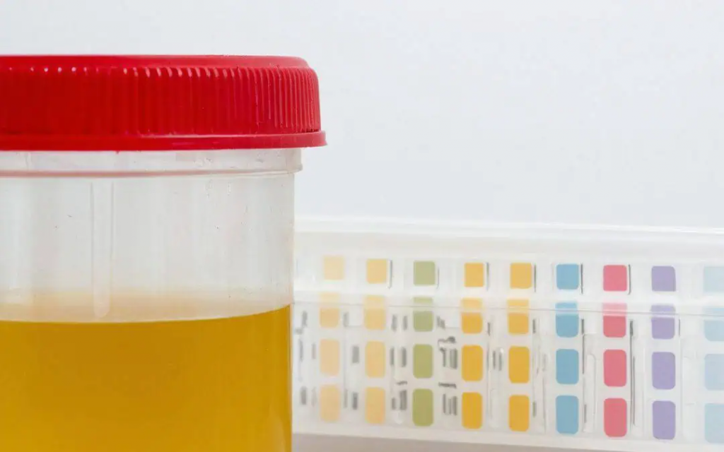 Urinalysis