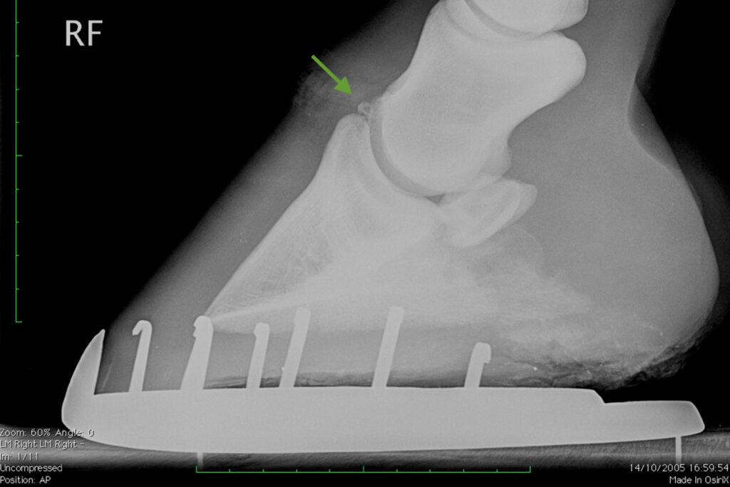 an xray image showing a bone fragment between the short pastern and the pedal bone in a horse