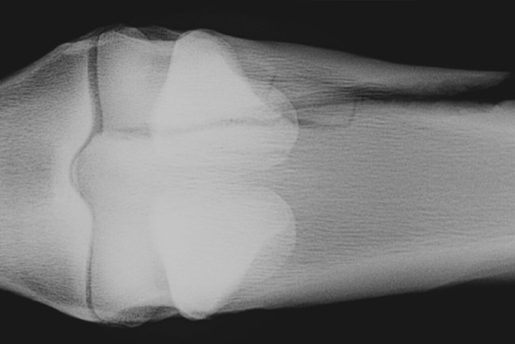 an xray image showing a complete fracture of the canon bone in a horse