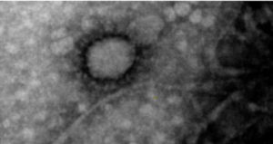 Fotografiaron el coronavirus que circula por Argentina: su importancia para la investigación científica