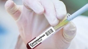 EU elaborará cepa de coronavirus para acelerar las pruebas de las vacunas