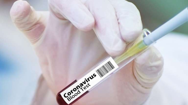 El mundo tiene 3 prometedores proyectos de vacuna contra COVID-19: esto es lo que tienes que saber de ellos