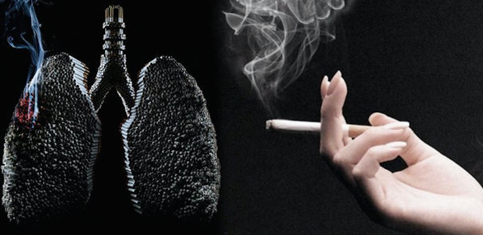 En Puebla mueren 16 pacientes diarios por causa del tabaquismo