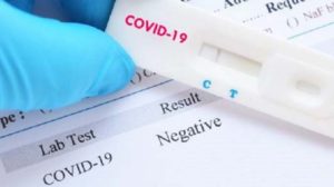 Secretaría de Salud, investiga pruebas rápidas de covid-19 ofertadas en redes sociales