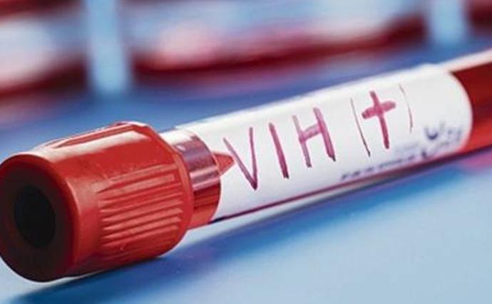 Experimento inédito deja a un paciente libre del VIH en Brasil