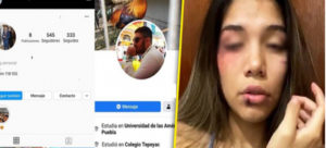 Denuncia estudiante de la UVM agresión de su ex novio alumnos de la UDLAP