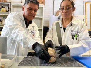 Crean en México el primer Banco de Cerebros