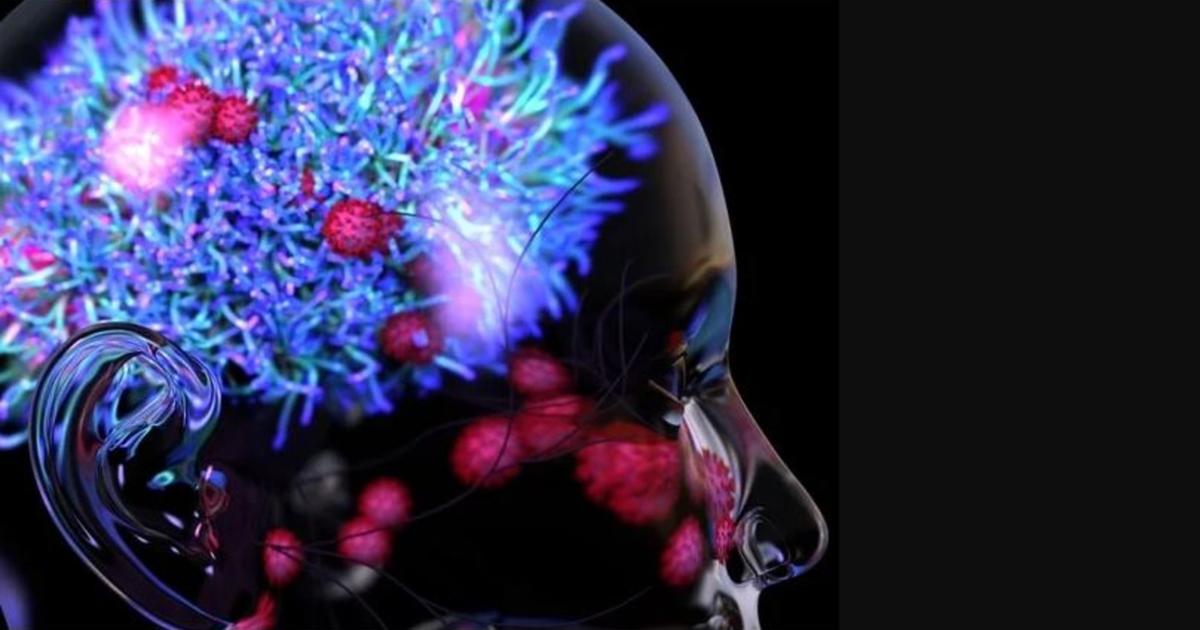 Estudio revela que la COVID-19 puede alojarse en el cerebro y causar la muerte