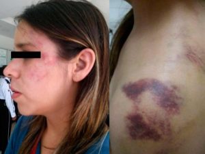 ‘No quiero que me asesine’; mujer pide ayude por temor a su pareja