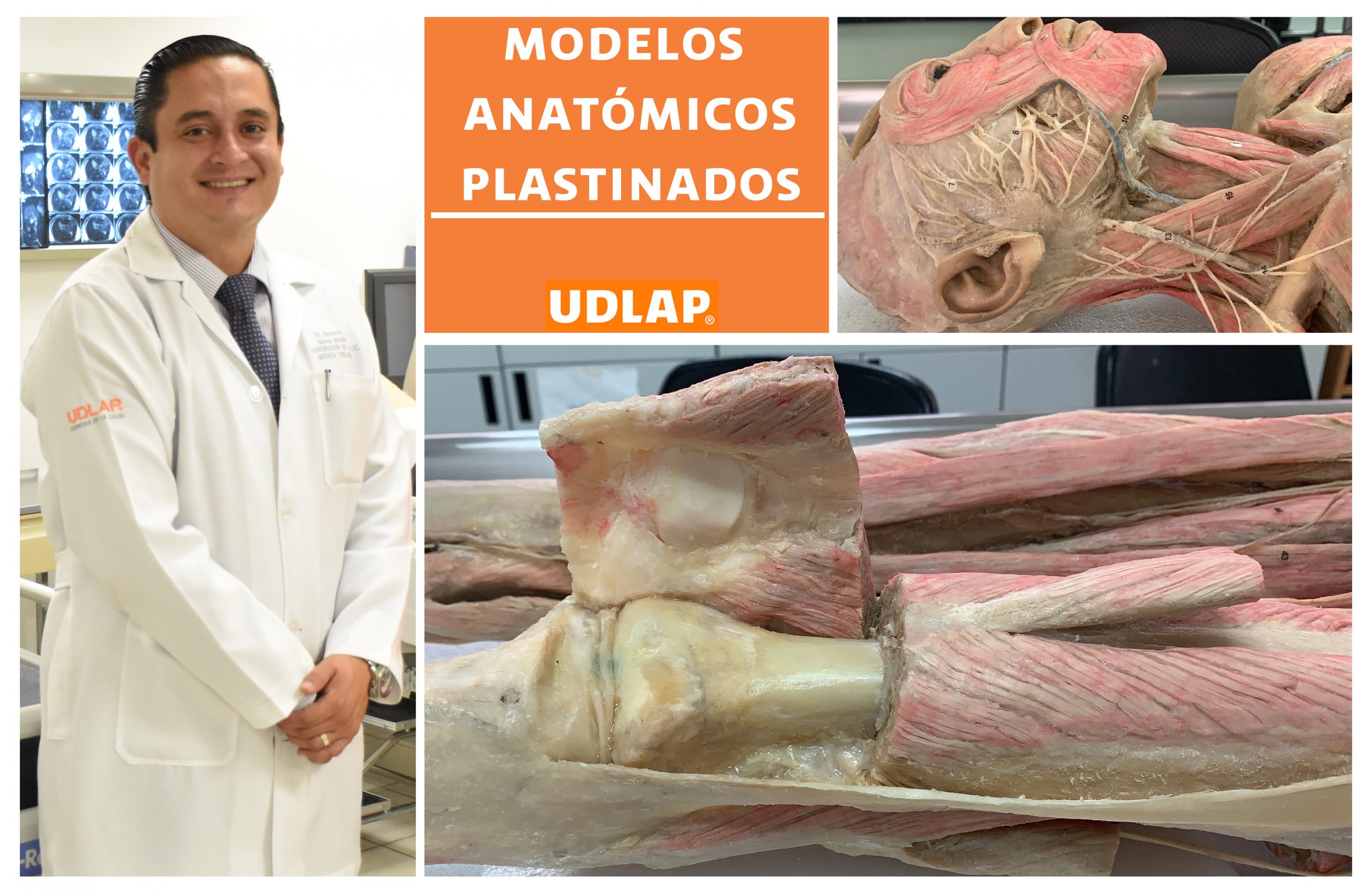UDLAP emplea modelos anatómicos por plastinación para el estudio de la anatomía humana