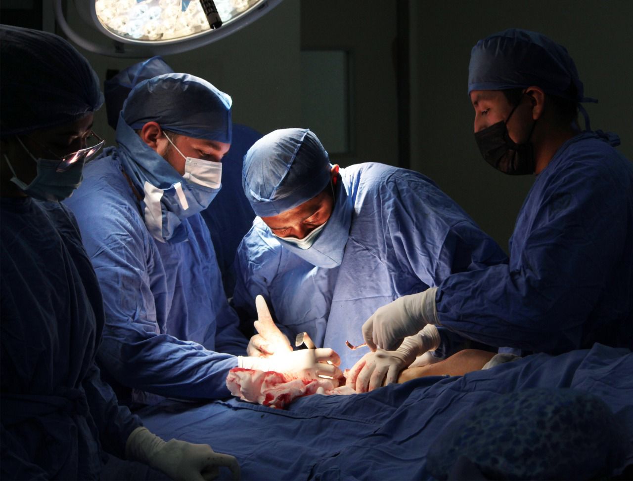 Crece 166 por ciento productividad en trasplantes del IMSS con mil 365 procedimientos