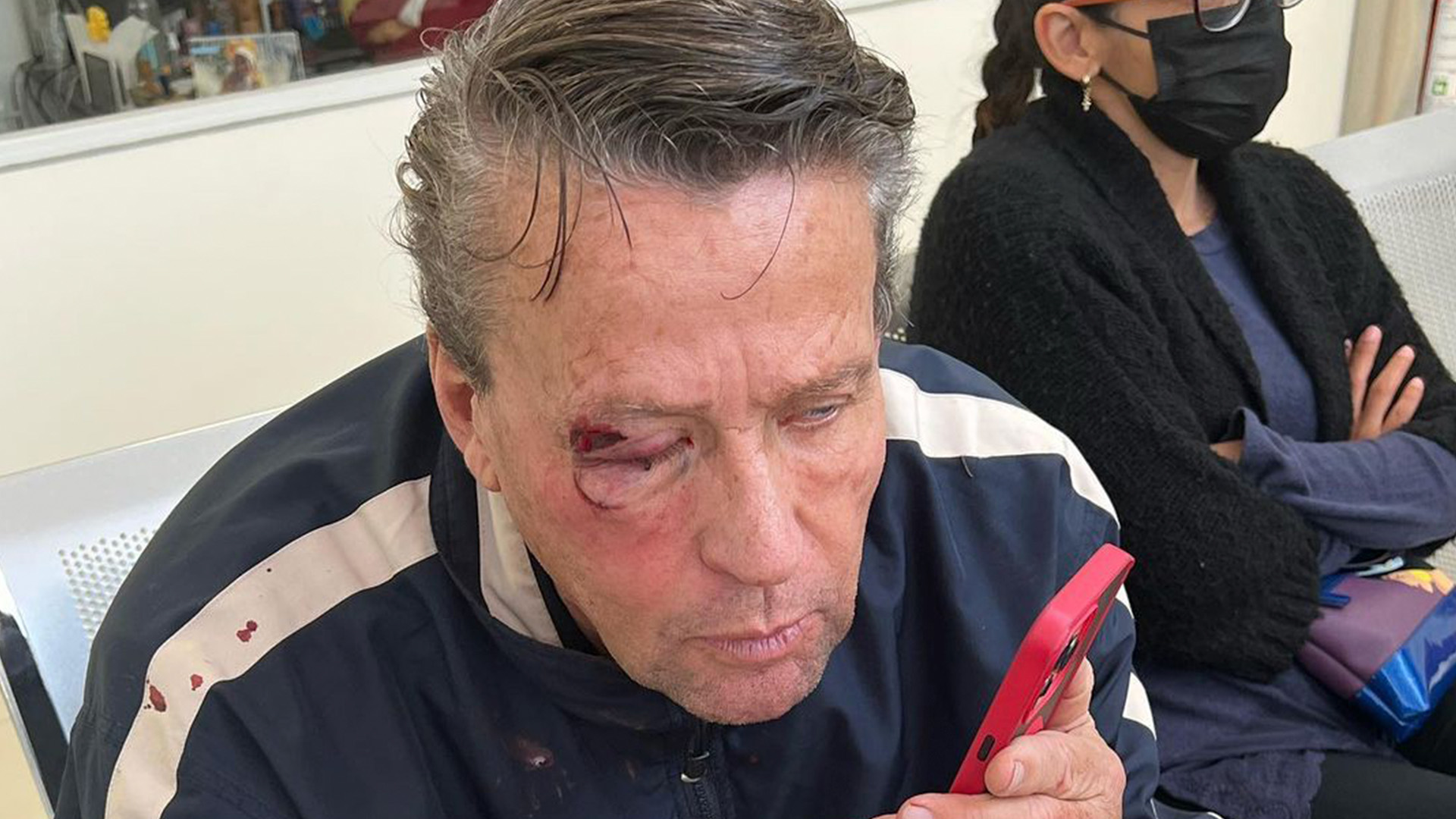 Alfredo Adame se vio involucrado en un conflicto nuevamente: recibe lesiones en el ojo