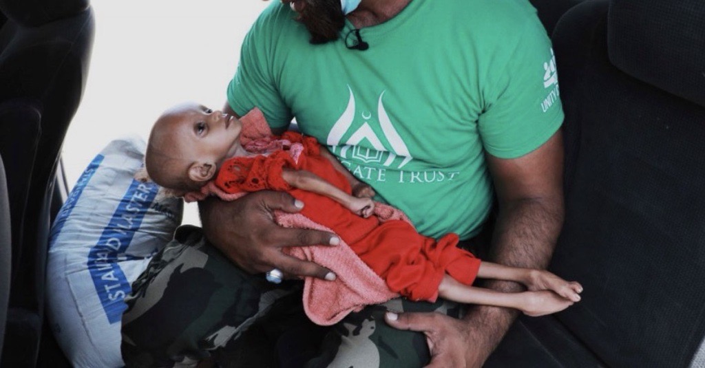 Malnourished Children’s Treatment Yemen (Zakat Applicable)