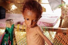 Zakariya,Musa&Eesa fundraiser for malnourished child in Yemen