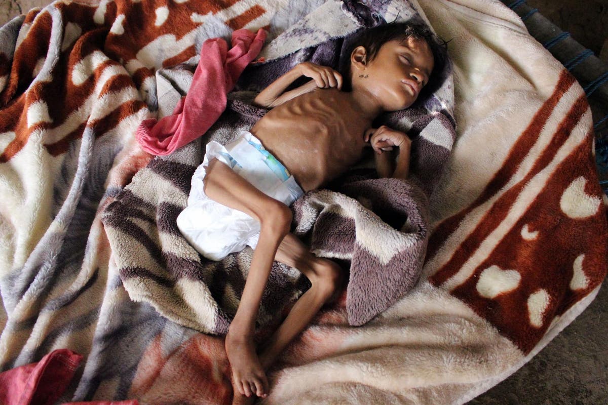 Children are starving in Yemen, Kindly help feed them.