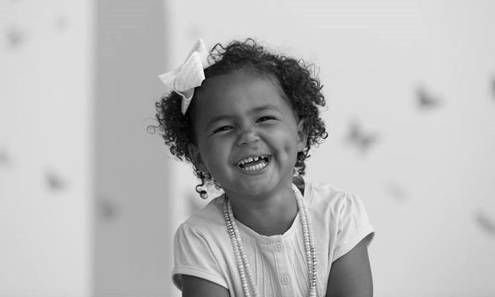 Successful cleft palate surgery on a small girl with white teeshirt, laughing hysterically, in Africa