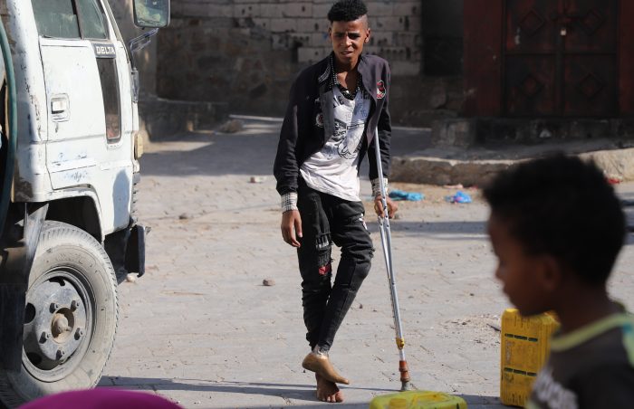 Young man with prosthesis in Yemen standing in the street