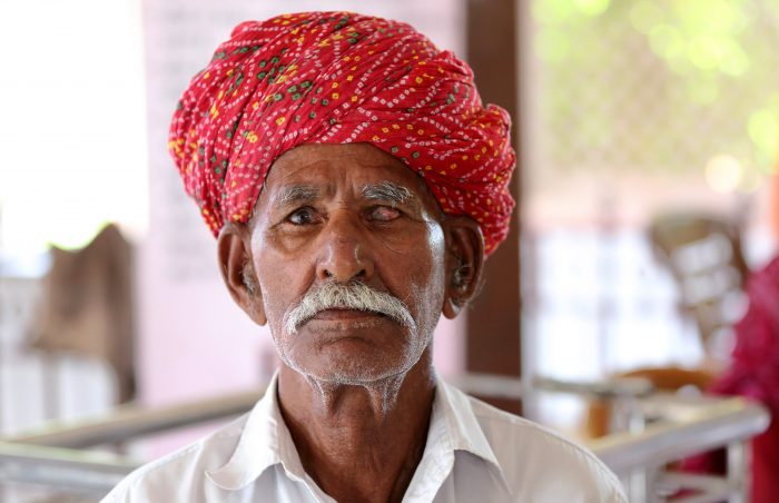 Old man in Pakistan with red turban and cataract eye condition