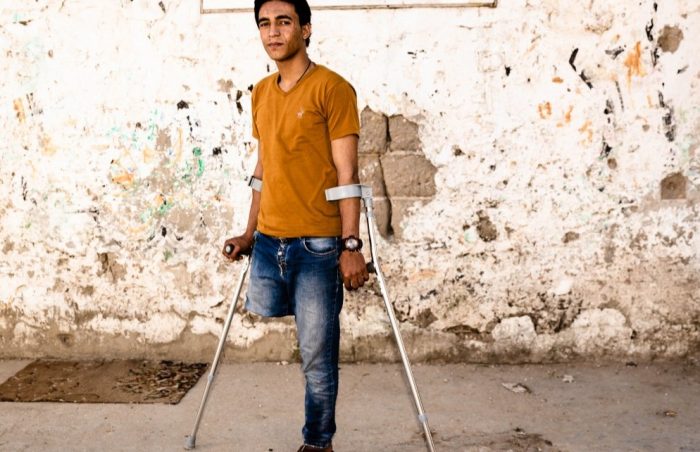 Man with orange t-shirt in Gaza, with crutches stands in the street.