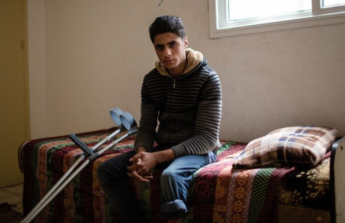 Young Palestinian man with crutches and the need for a prosthesis sits on the bed in Gaza