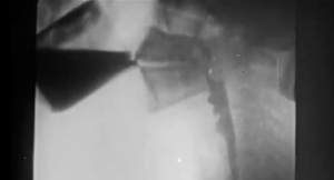 Cineradiographic Vision