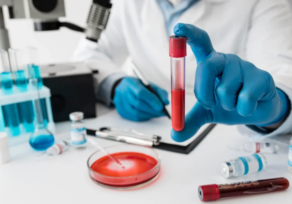 Soal UKOM Hematologi