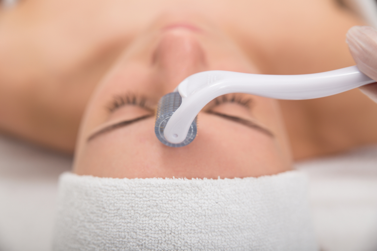 Deets on the Derma-Roller and Why Puncturing Your Skin May Be Worth It