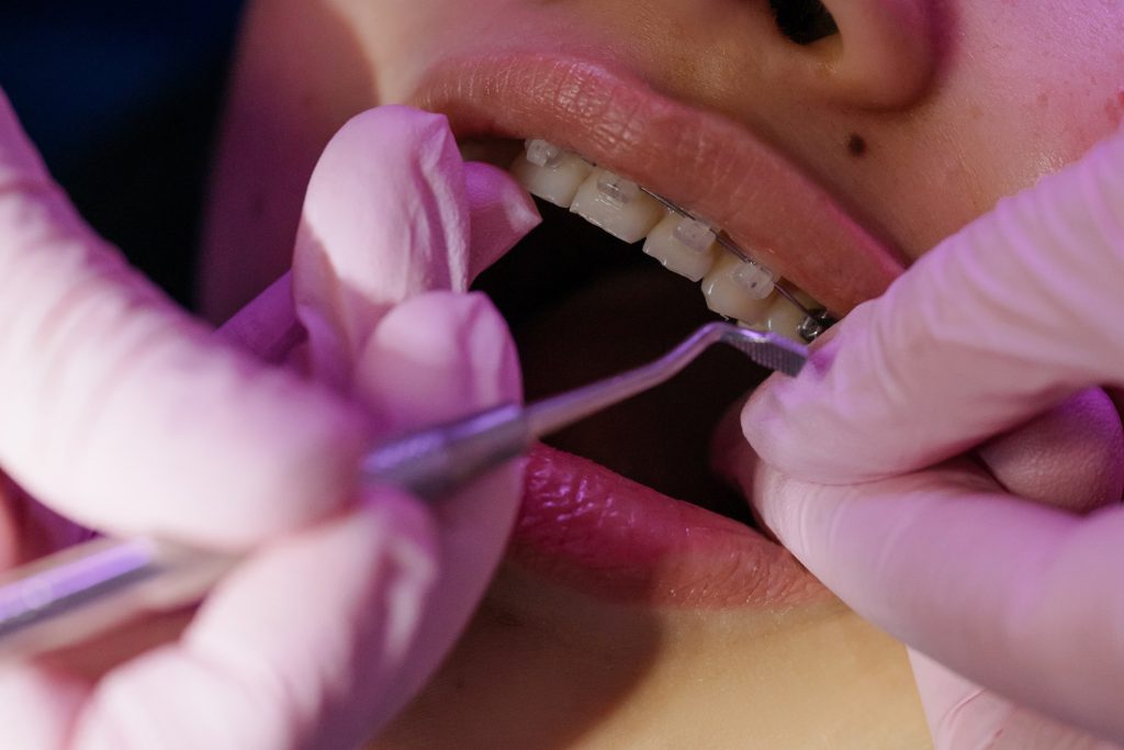 Dentist working on patients teeth