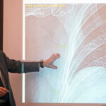 Dr. Wendell Gibby points to rib fractures