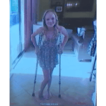 photo of maya kowalski on crutches