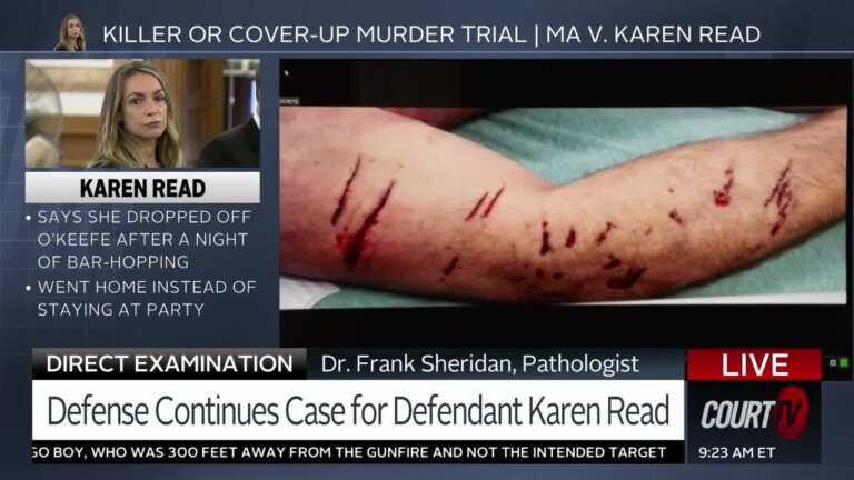 O'Keefe's injuries on display in court