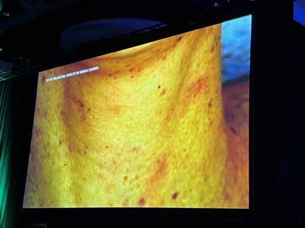 photo shows marks on neck