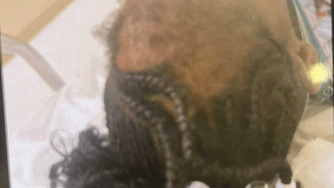 photo of injured child