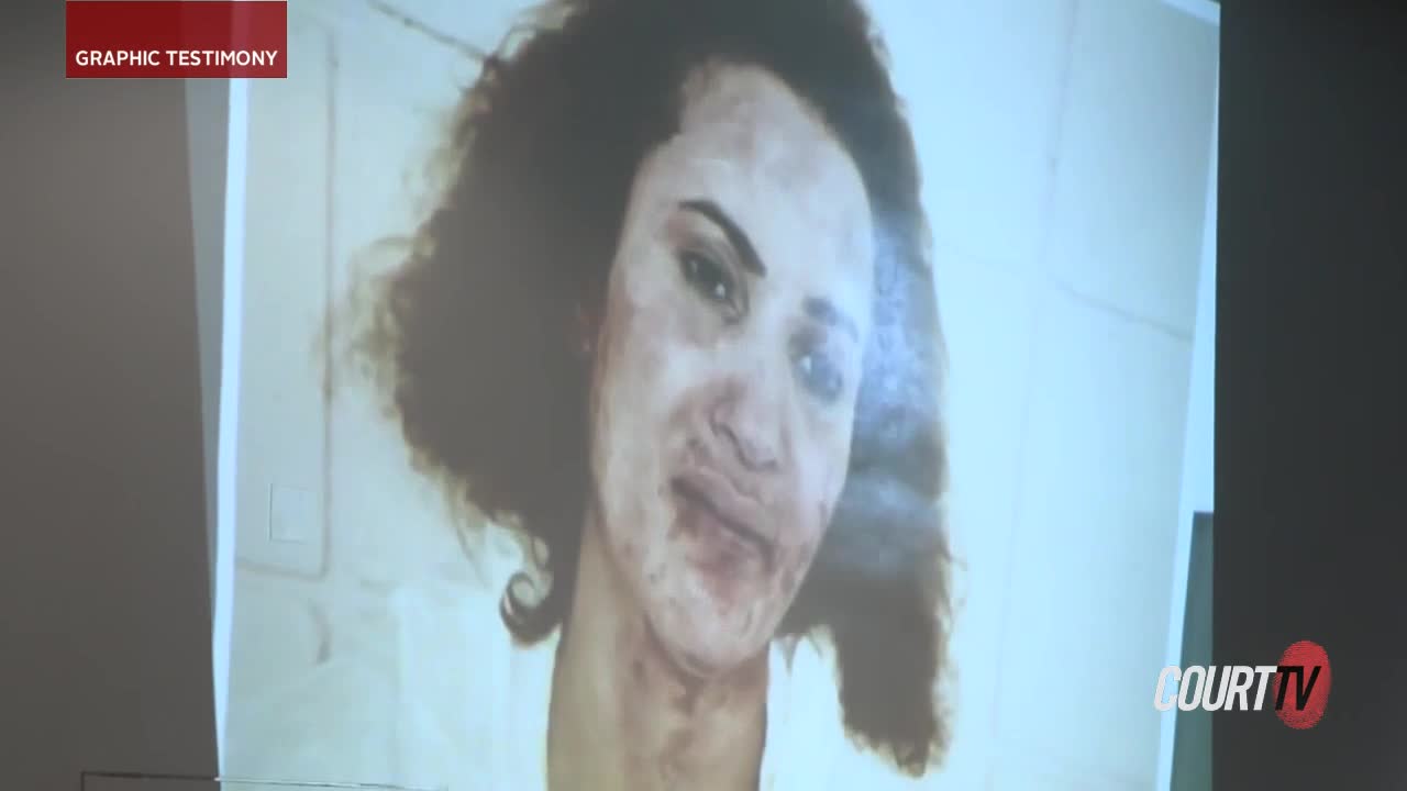 photo of Lucy Medina with bloody face