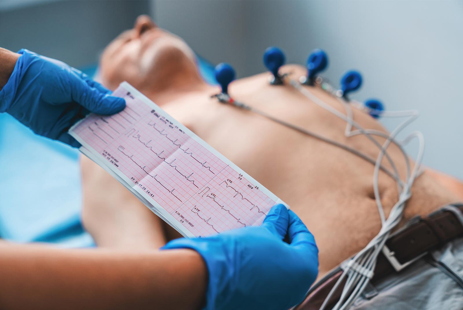 容易喘、疲累或腳腫?長庚醫院AI整合心電圖,及早發現心臟衰竭|銀天下