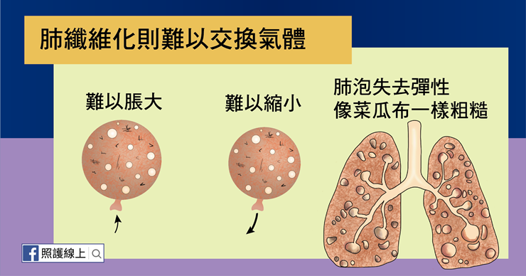 新冠肺炎後遺症 肺纖維化 是什麼 有什麼症狀又該如何治療 天下雜誌