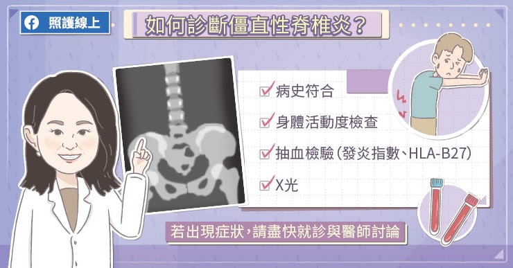 如何診斷僵直性脊椎炎?