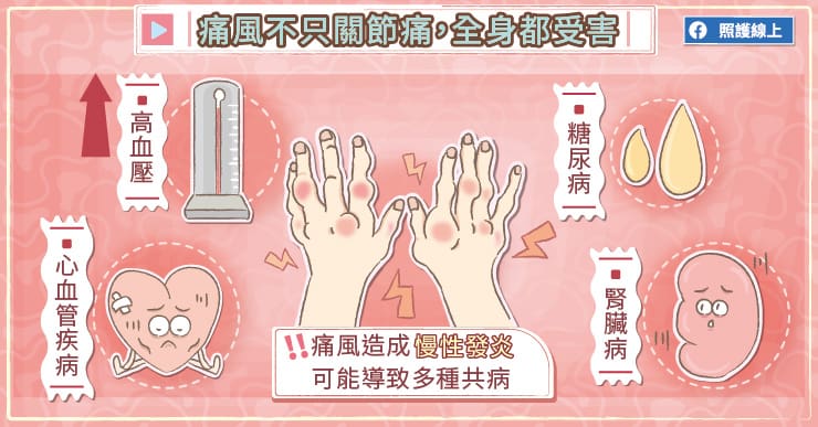 痛風不只關節痛,全身都受害