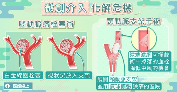 頸動脈支架,拓寬頸動脈