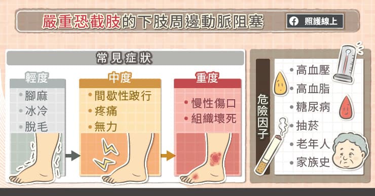 嚴重恐截肢的下肢周邊動脈阻塞