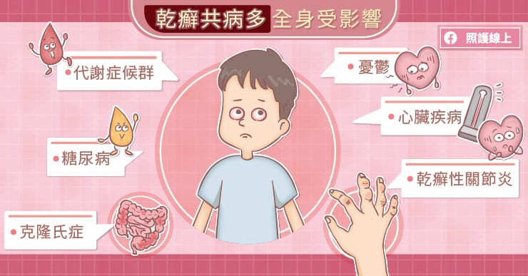 乾癬共病多,全身受影響