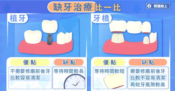 缺牙治療比一比