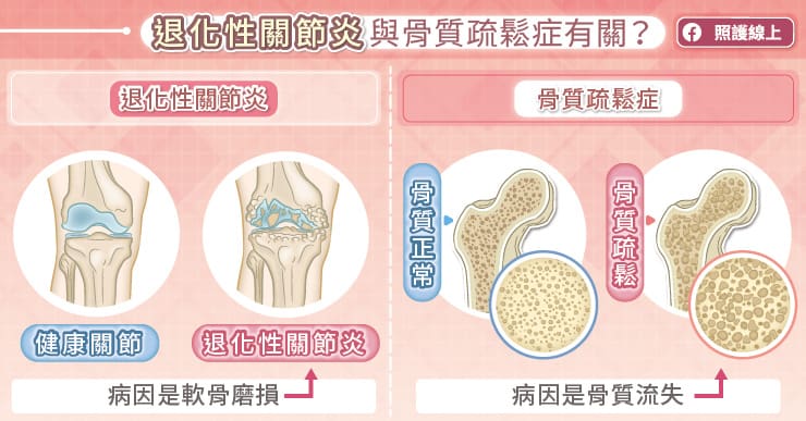 退化性關節炎與骨質疏鬆症有關？