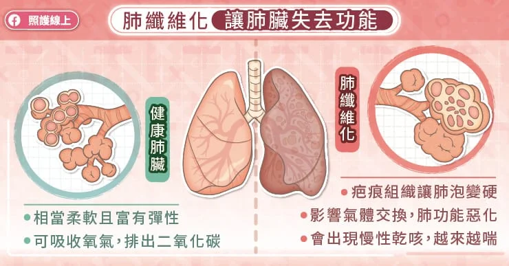 肺纖維化,讓肺臟失去功能