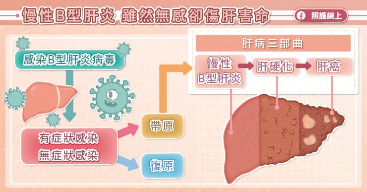 小心慢性B肝，無感卻致命！如何預防肝硬化、肝癌？肝臟專家詳解｜天下雜誌