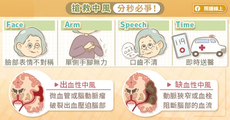搶救中風,分秒必爭